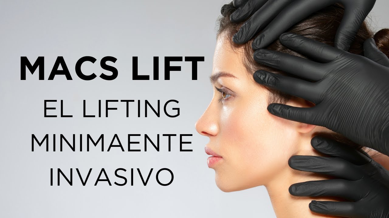 MACS LIFT: EL LIFTING MINIMAMENTE INVASIVO
