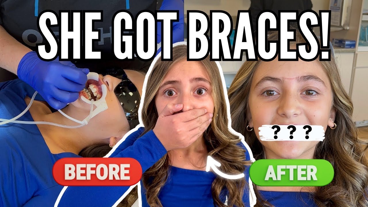 Hallie Gets BRACES! The Wait is Finally Over | Before & After First Time Braces