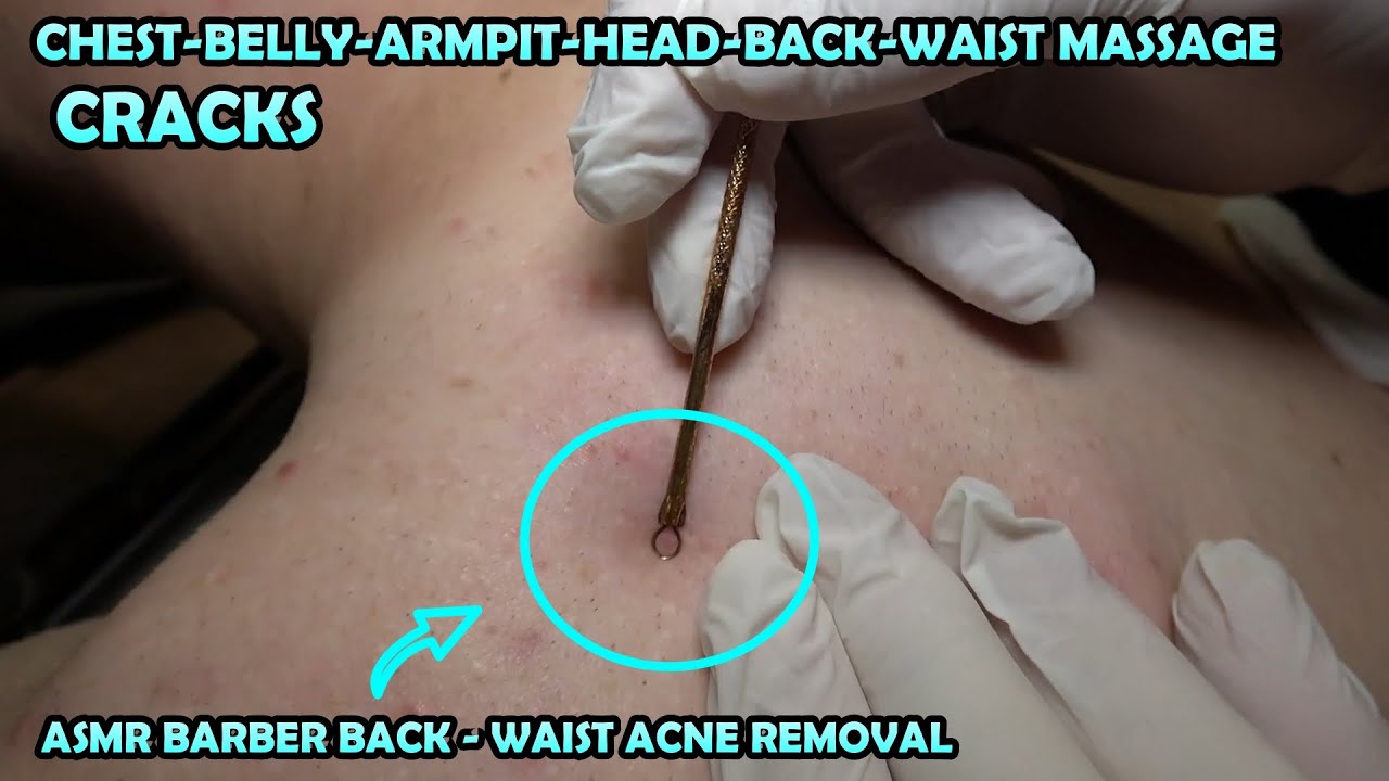ASMR BARBER BACK ACNE REMOVAL AND MASSAGE 💈 RAZOR BACK SHAVE 💈 CRACKS 💈 DEEP TİSSUE MASSAGE FOR YOU