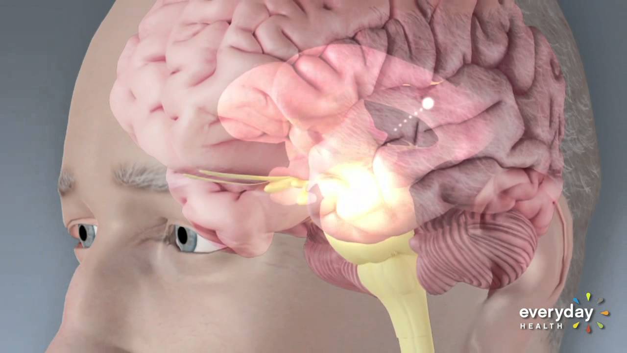 Laser Technology Helps Parkinson's Patients Walk