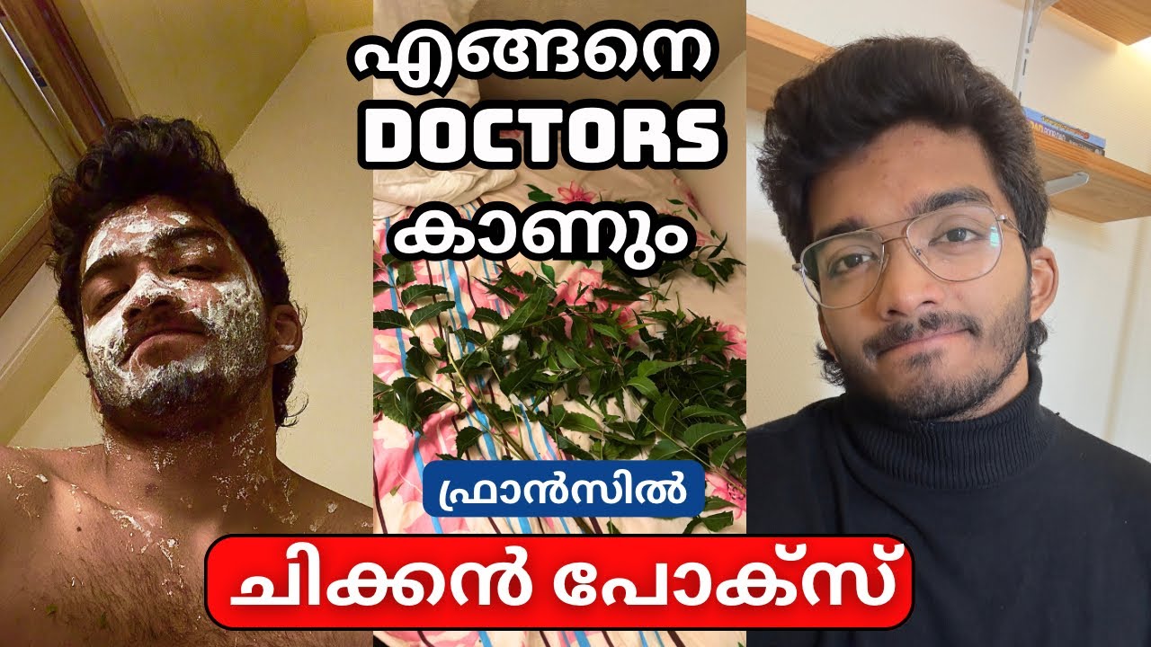 Chicken Pox - Sharing Experience | How to see a doctor in France | Social Security