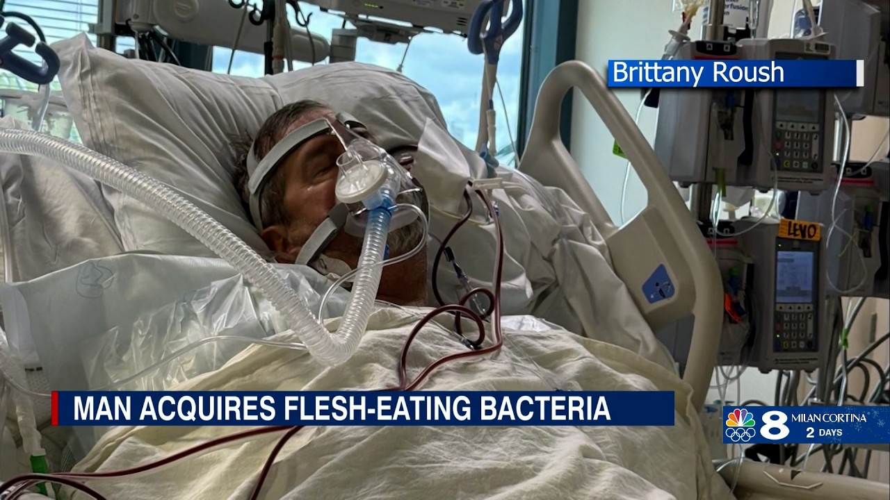 Tampa man battles flesh-eating bacteria; 4 killed, 8 injured in Polk crash | Tampa Bay headlines