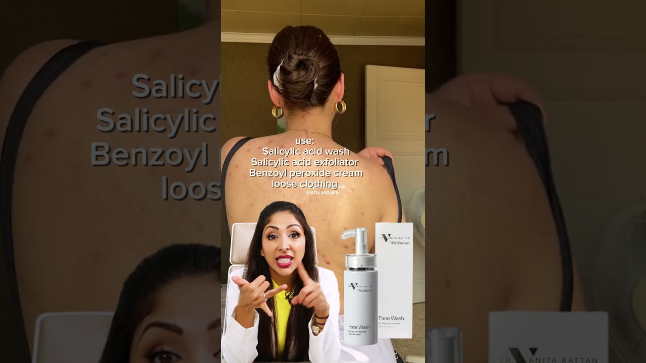 Back acne Routine