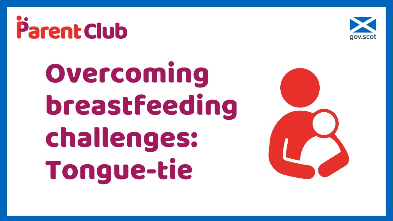 Overcoming breastfeeding challenges: Tongue-tie