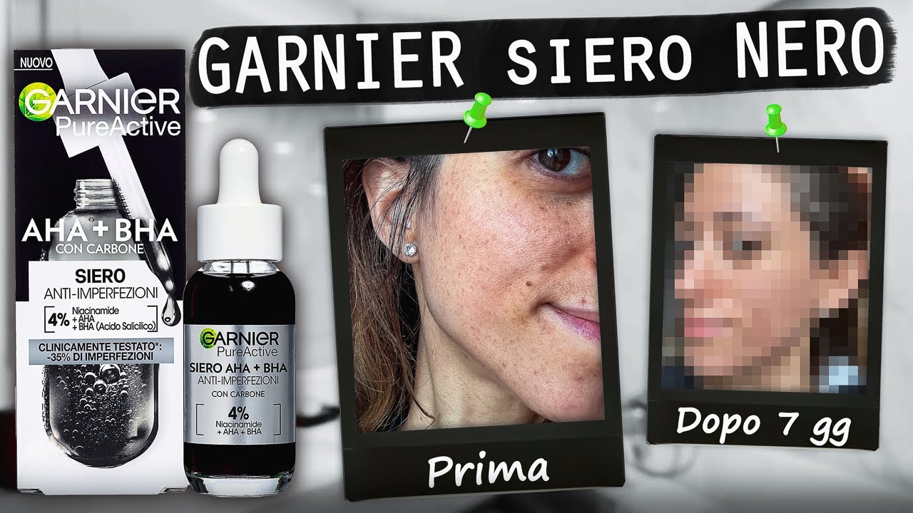 Recensione GARNIER SIERO NERO anti imperfezione con CARBONE 🖤 (TESTATO per 7 GIORNI!)