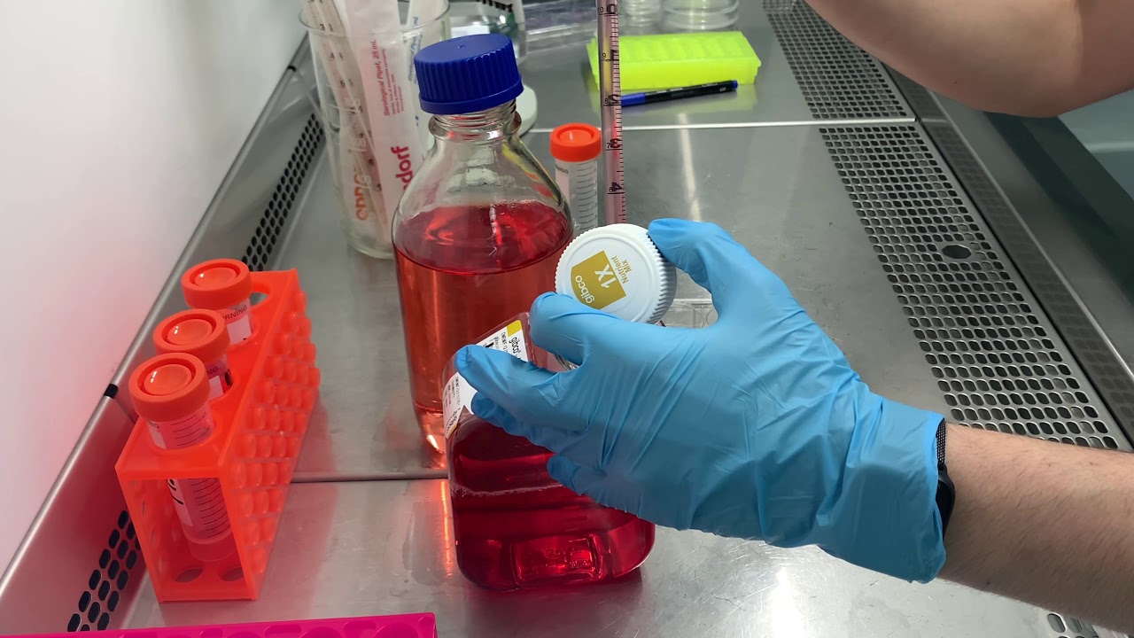 Isolation and passaging of primary breast tumor cells