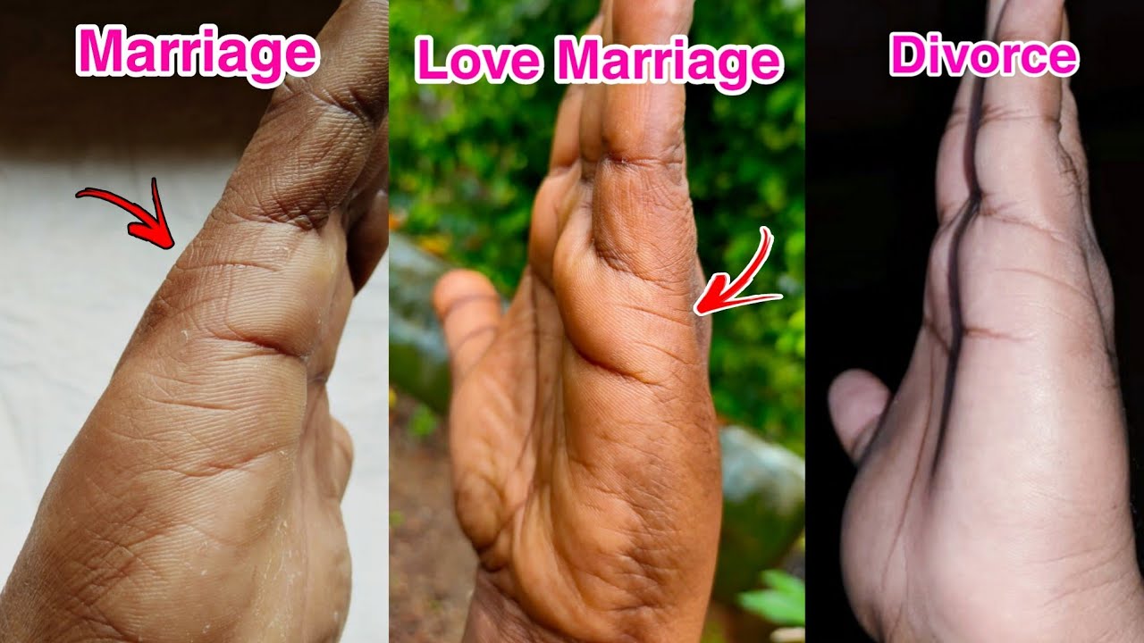 നിങ്ങൾ വിവാഹം കഴിക്കുന്നത് ഉചിതമായ സമയത്താണോ👪👩‍❤️ ? Marriage Line Explanation In Malayalam Part-1
