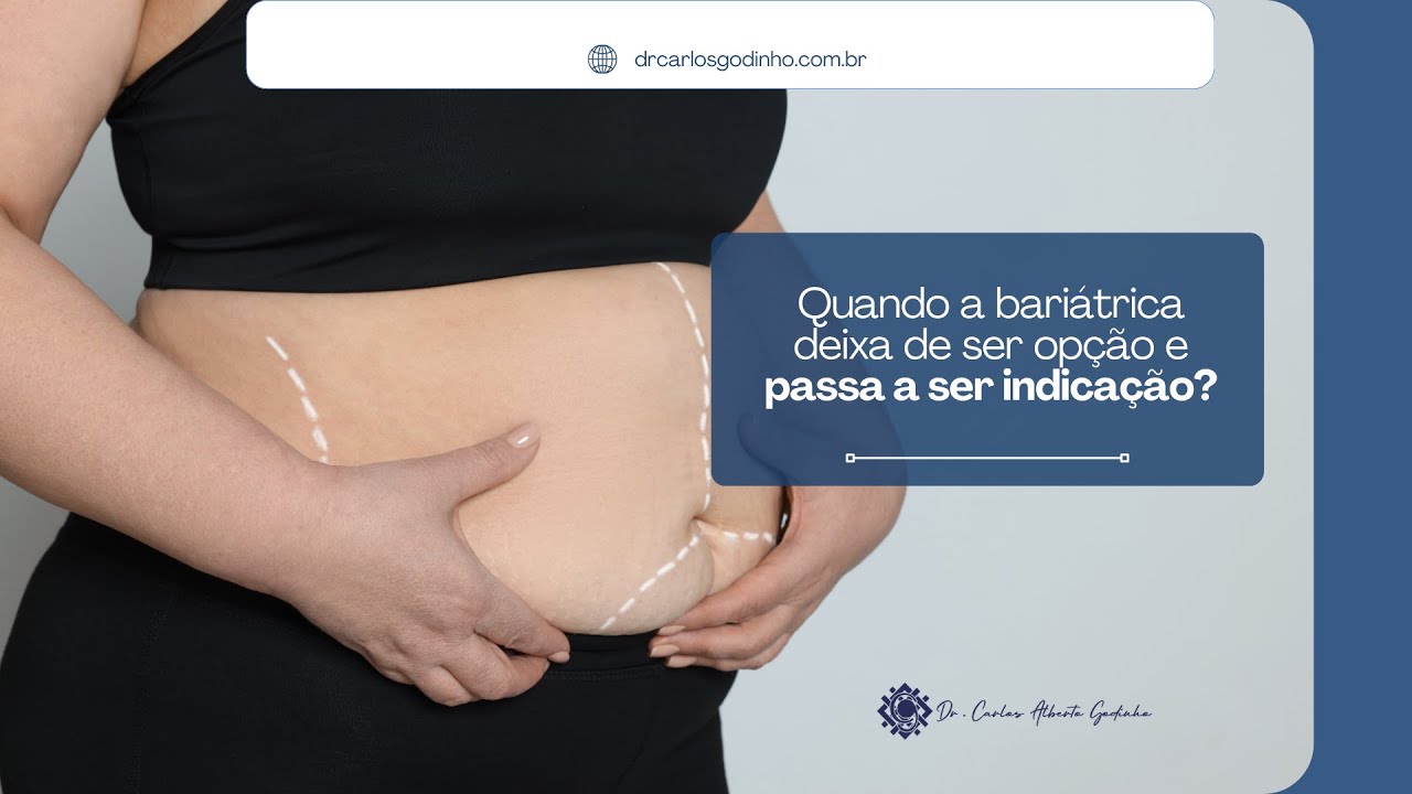 Quando a bariátrica deixa de ser opção e passa a ser indicação? | Dr. Carlos Godinho CRM-SP 76797