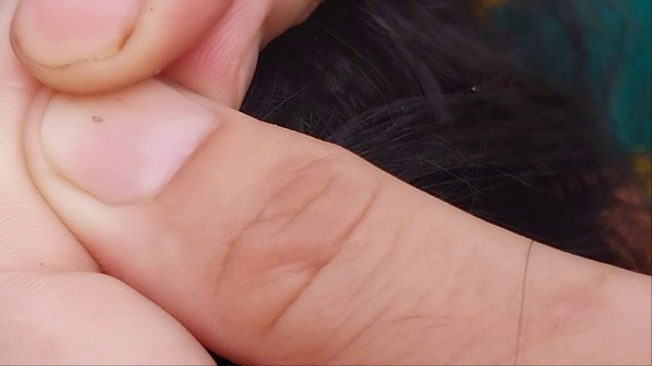 Nitpicking ASMR video 279    #nitpicking #asmr #kuto #piolhos #petantumo #licepicking #catandopiolho