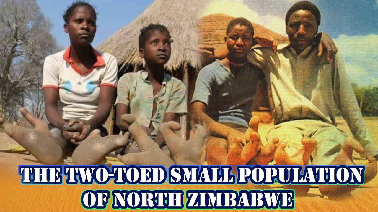 The Two-Toed Small Population Of North Zimbabwe