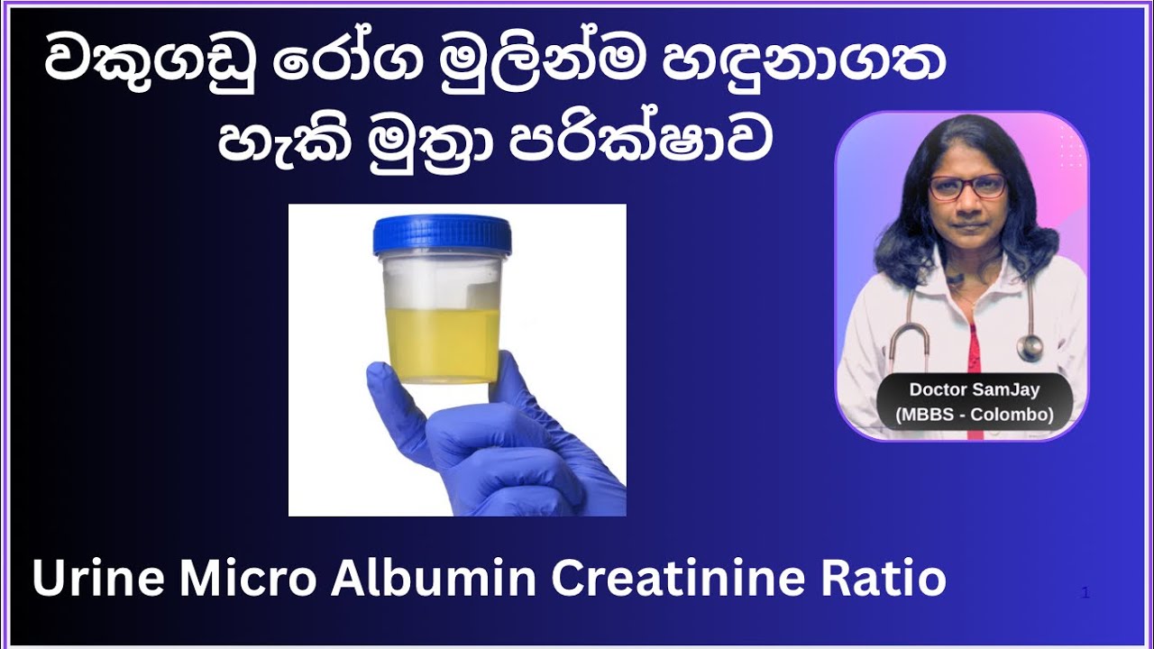 Urine micro albumin test /වකුගඩු damage වෙලාද?මුත්‍රා සමග ප්‍රෝටීන් පිටවීම#diabeticnephropathy 