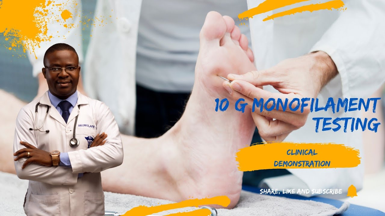 10G monofilament test for Peripheral neuropathy