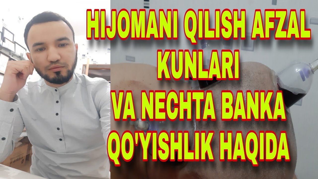 HIJAMA QILISHNI AFZAL KUNLARI VA NECHTA BANKA QO'YISHLIK HAQIDA
