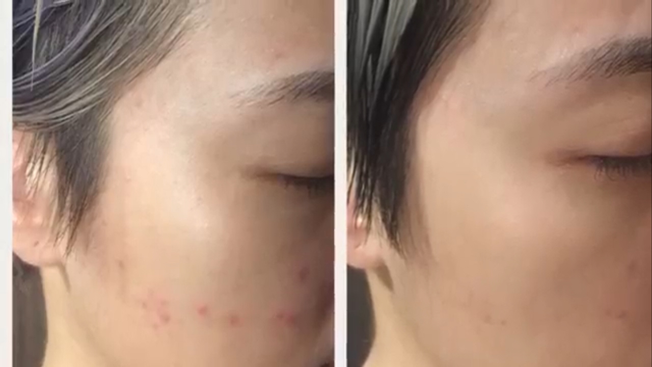 My 20 days testimonial on Mary Kay Timewise Replenishing Serum +C