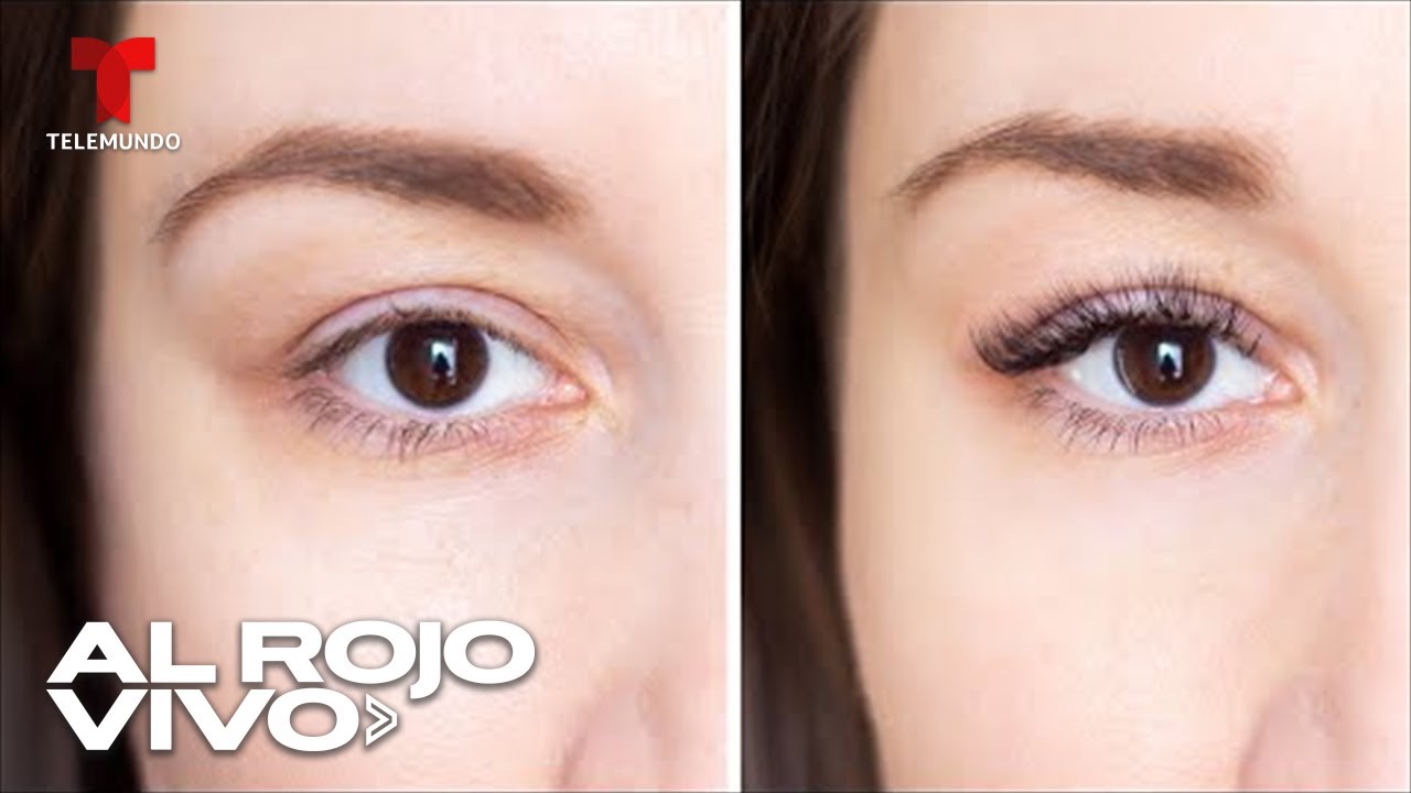 Dermatólogo crea injertos de pestañas usando el cabello de pacientes