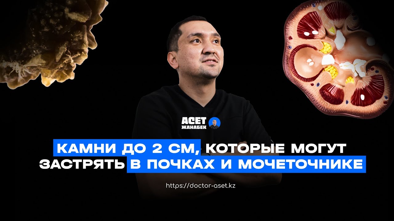 КАМНИ ДО 2 СМ В ПОЧКАХ И МОЧЕТОЧНИКЕ, КОТОРЫЕ МОГУТ ЗАСТРЯТЬ [Асет Жанабек, уролог-андролог]