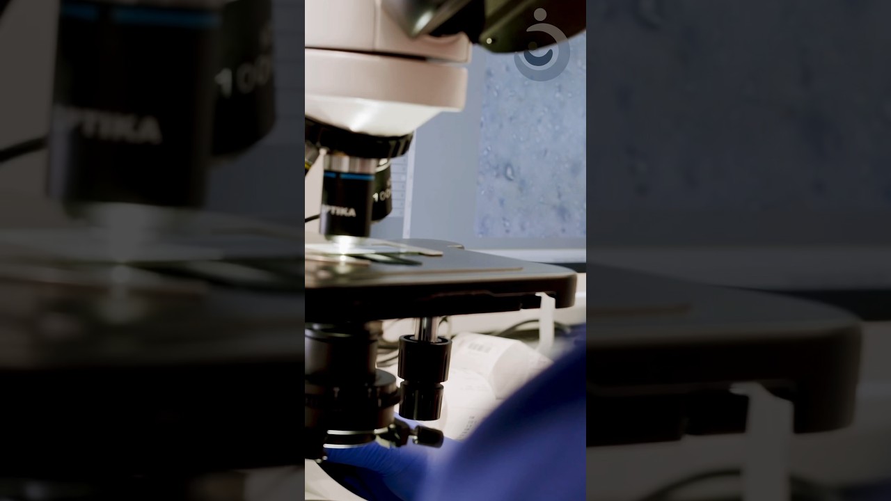 IUI Procedure: A Step-by-Step Guide to Intra-Uterine Insemination #infertilityjourney #pregnancy
