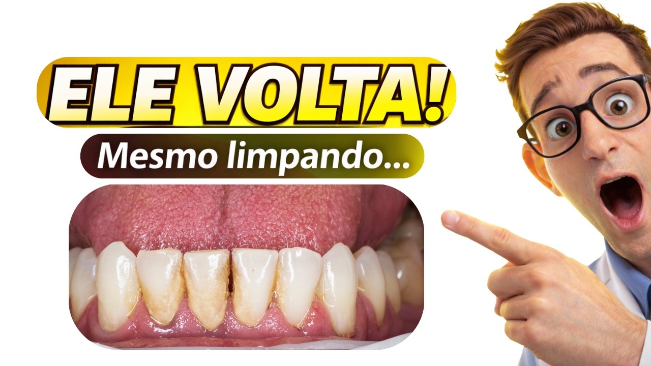 Por que o TÁRTARO sempre VOLTA? (mesmo escovando os dentes)