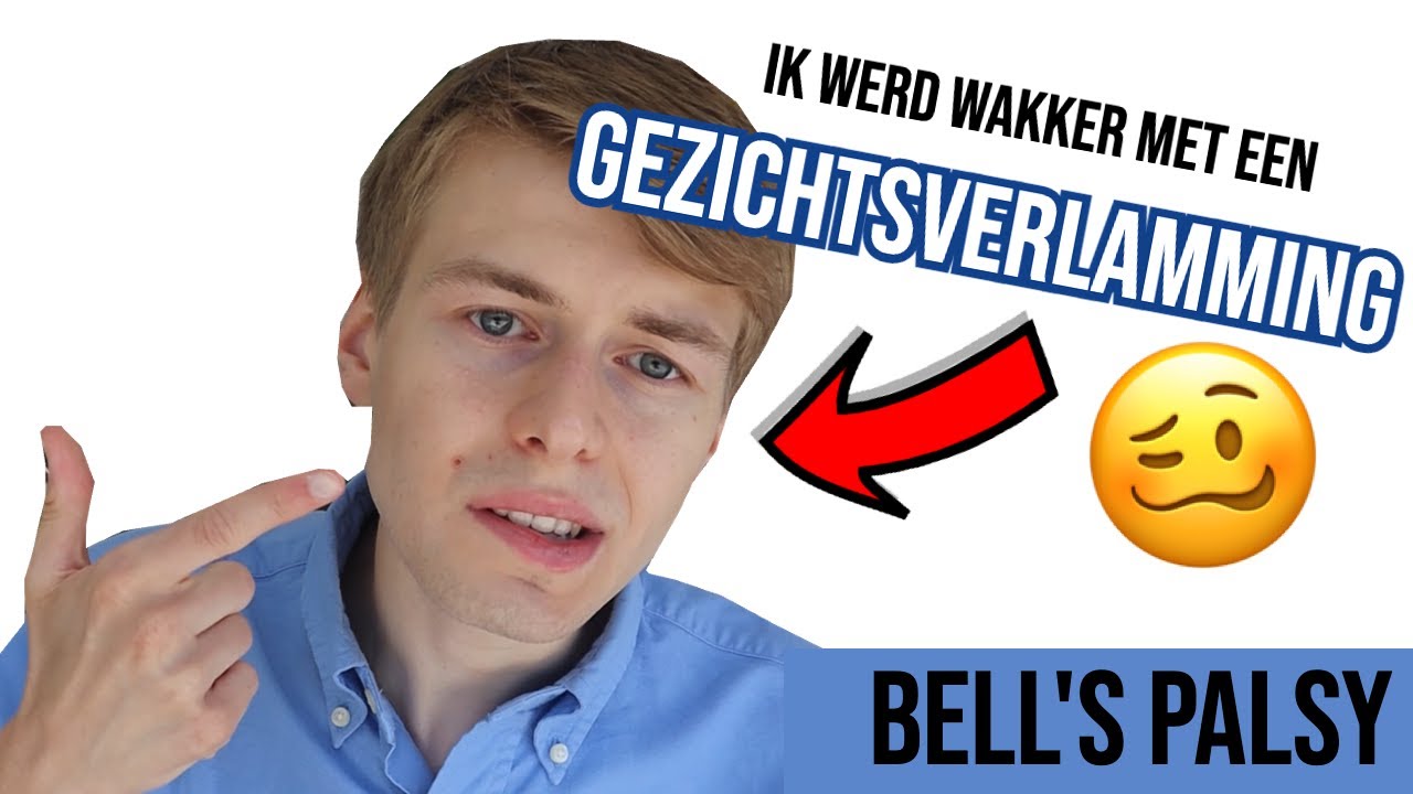 Ik kreeg de diagnose van Bell's Palsy (halfzijdige gezichtsverlamming) 🥴