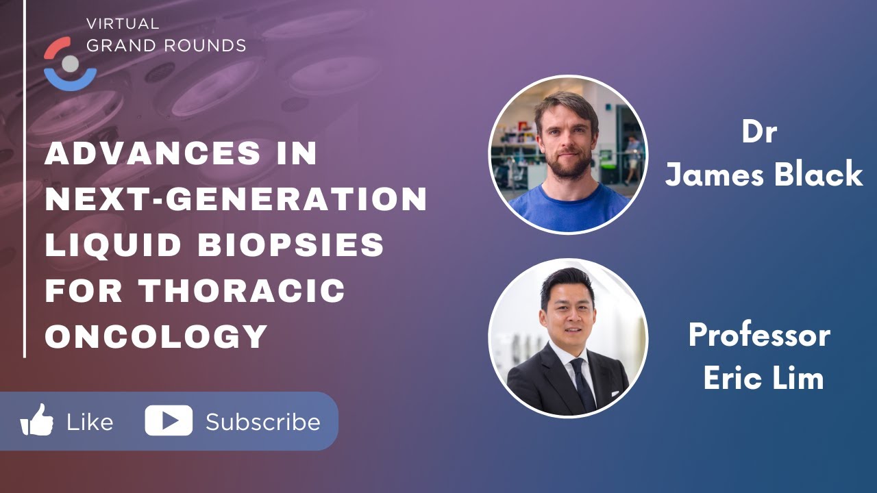 Advances in Next-Generation Liquid Biopsies for Thoracic Oncology | Dr James Black