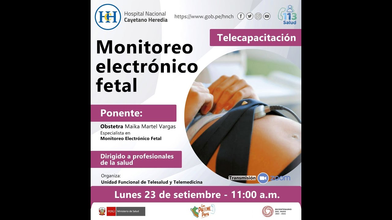 Monitoreo electrónico fetal