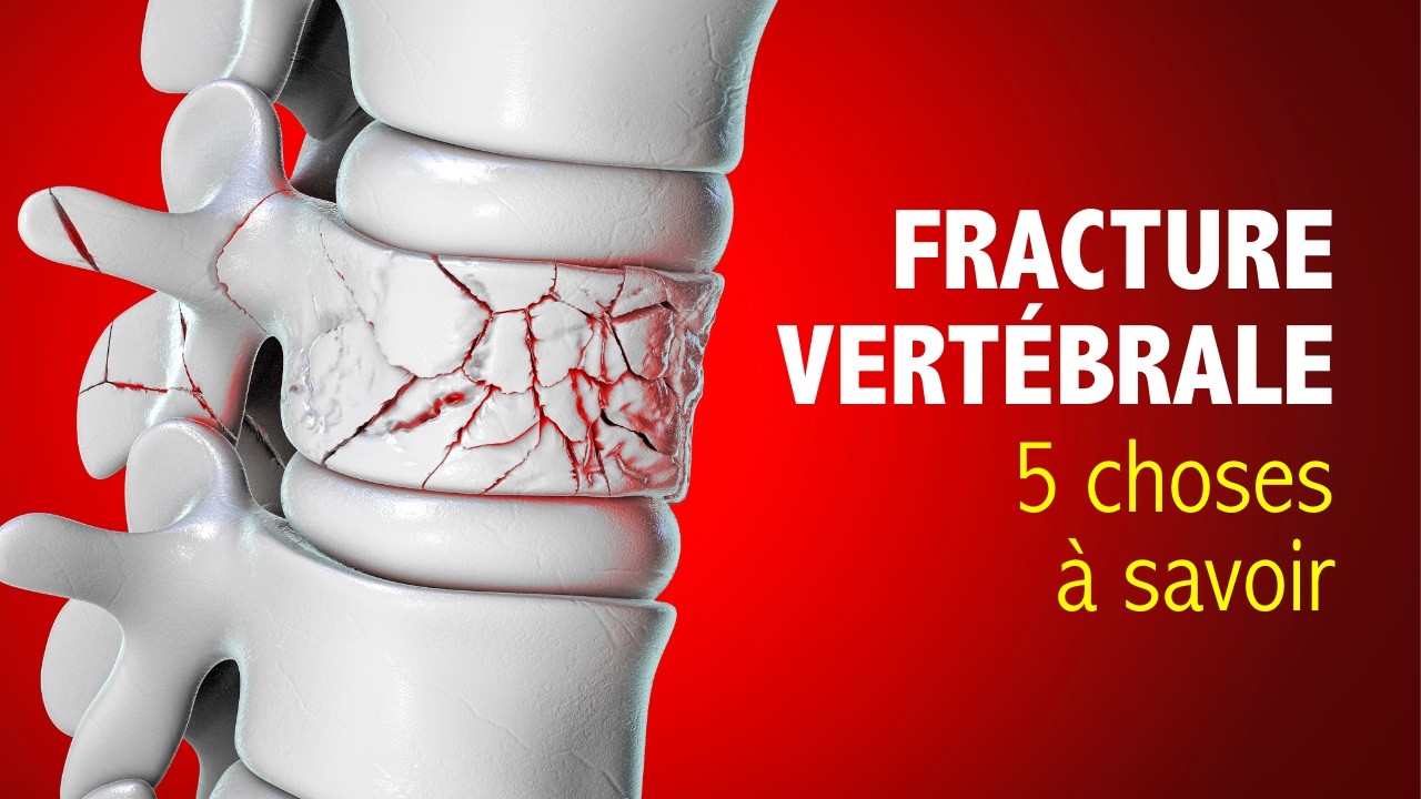 Fracture vertébrale : 5 choses savoir pour les prévenir !