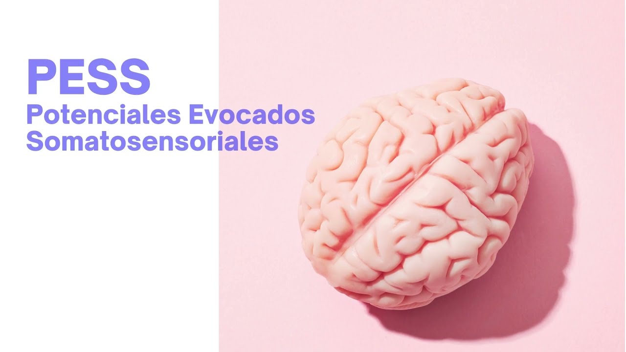 PESS POTENCIALES EVOCADOS SOMATOSENSORIALES EN NERVIO MEDIANO