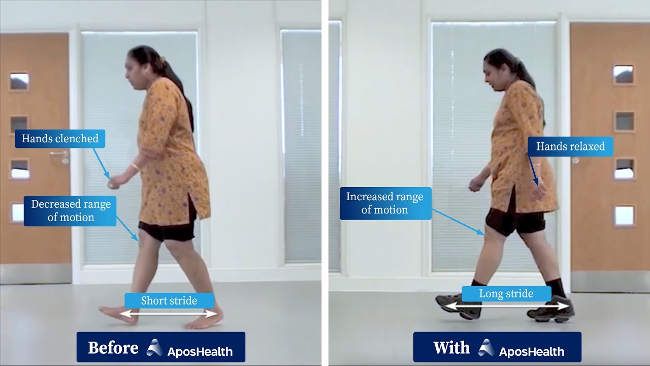 Before and After Knee Treatment - Apos&reg;