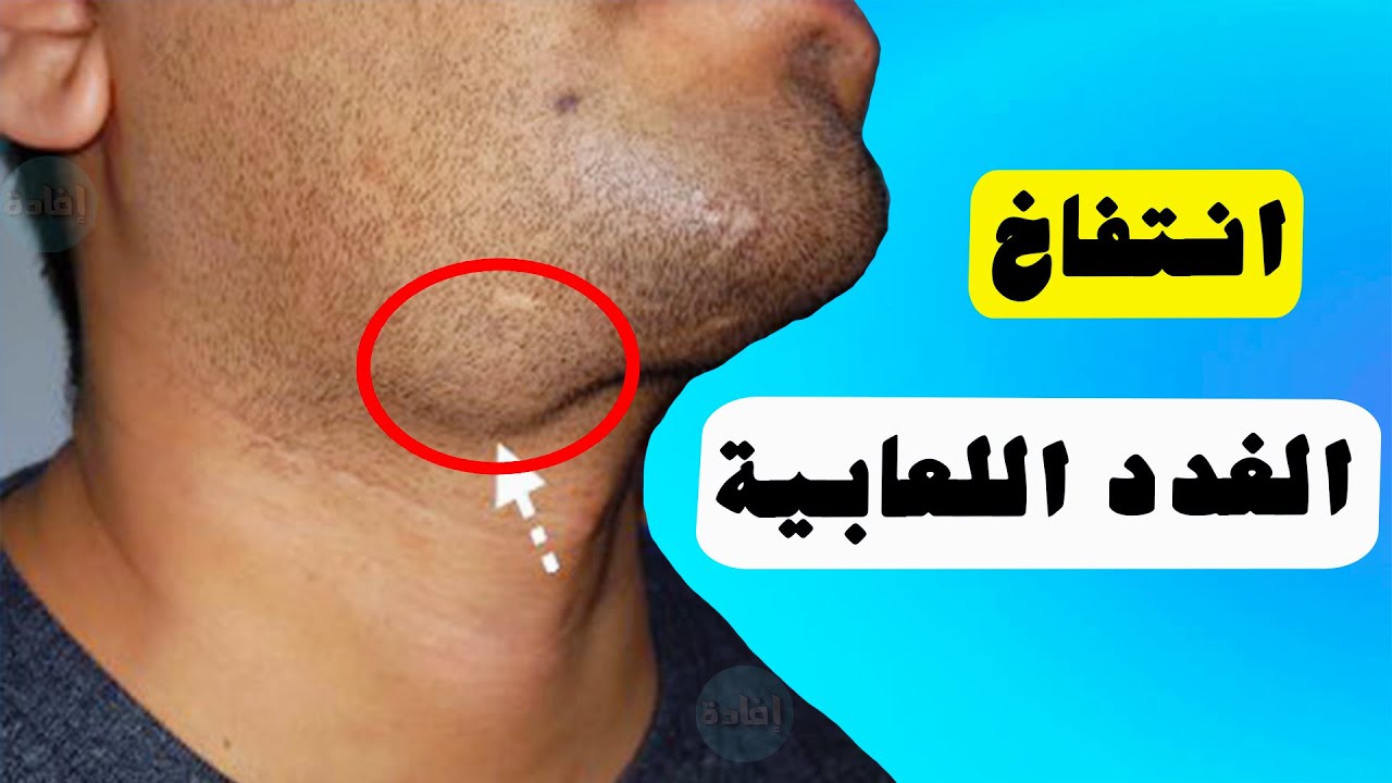 هل انتفاخ الغدد اللعابية تحت الفك السفلي خطیر ؟