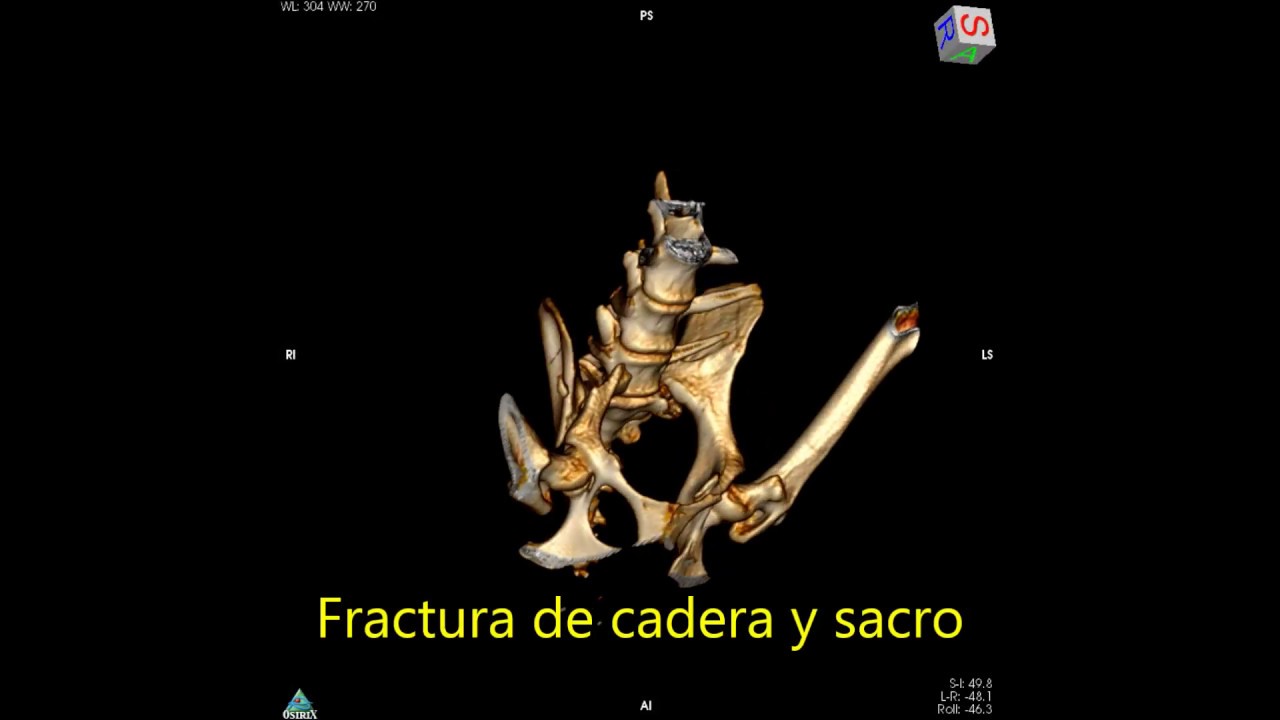 Fractura de cadera y sacro en un perro