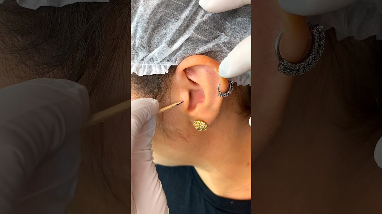 Lindo Piercing no Tragus 😍💥 #piercing #shortsvideo #shortsyoutube