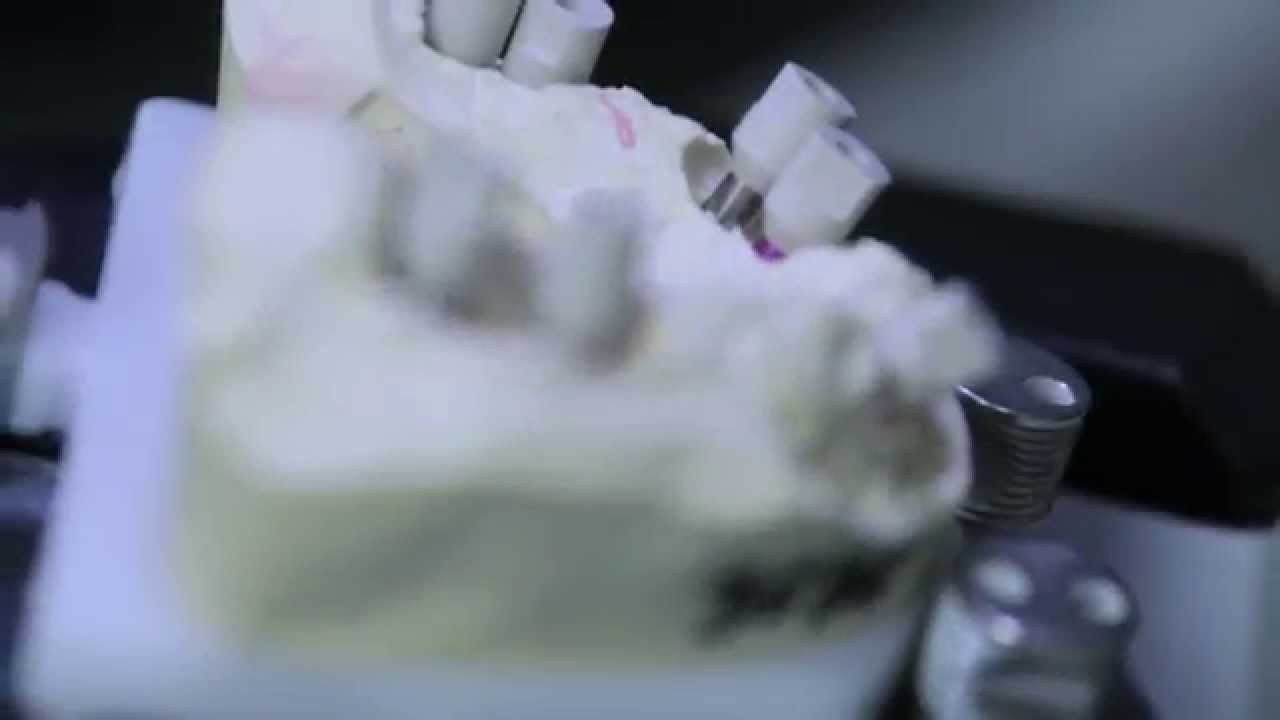 Milling and Selective Laser Melting Center wellCAMdent