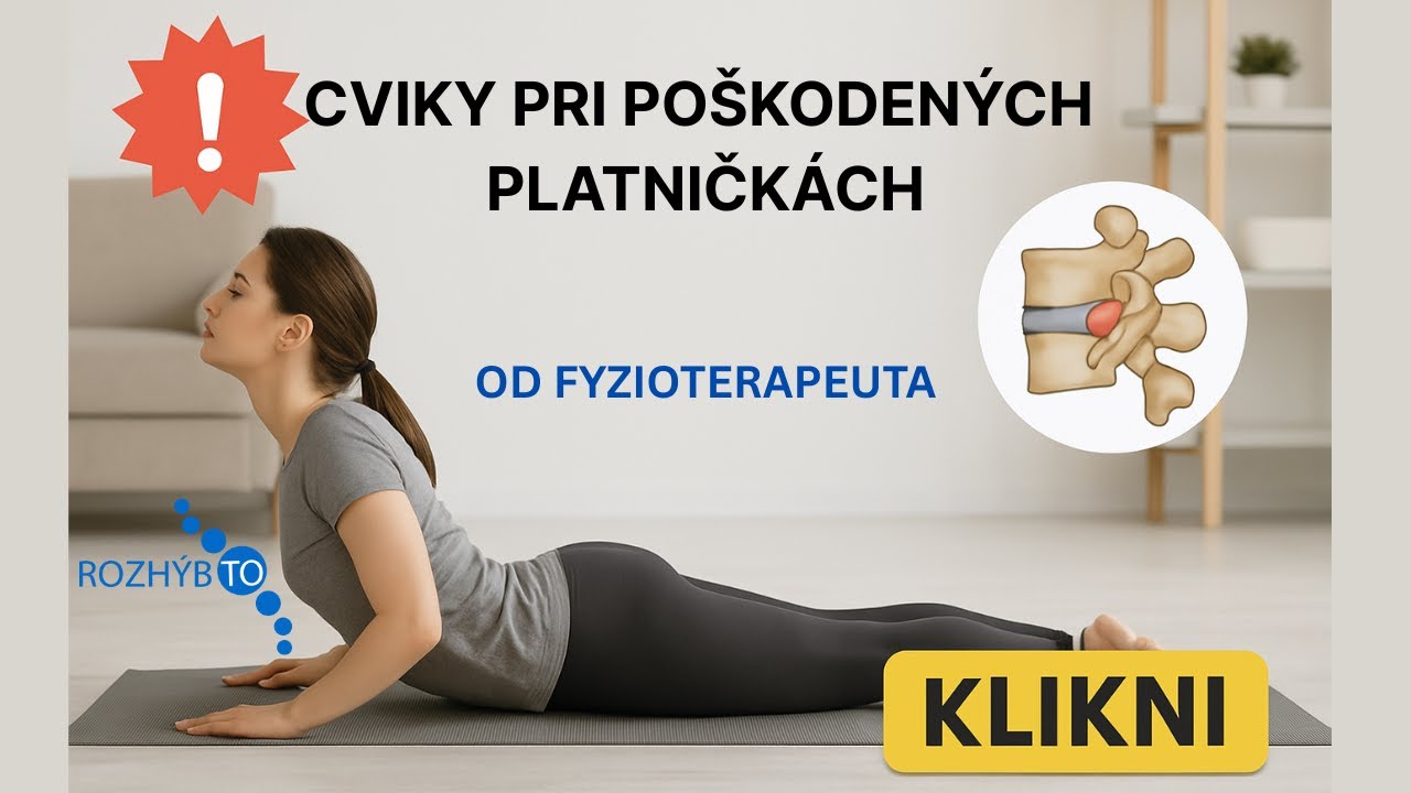 Najlepšie cviky pri ,,vyskočených platničkách