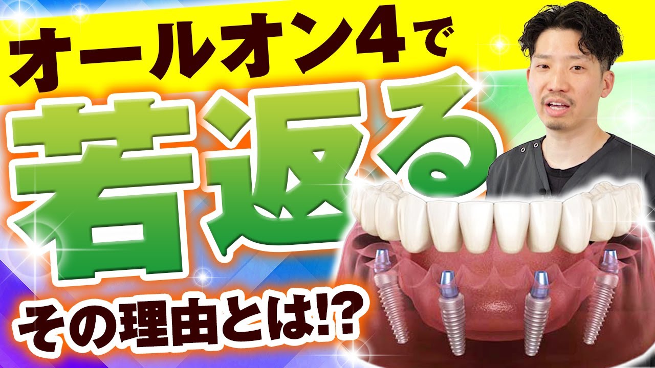【意外と知らない】オールオン4の様々なメリットとは？