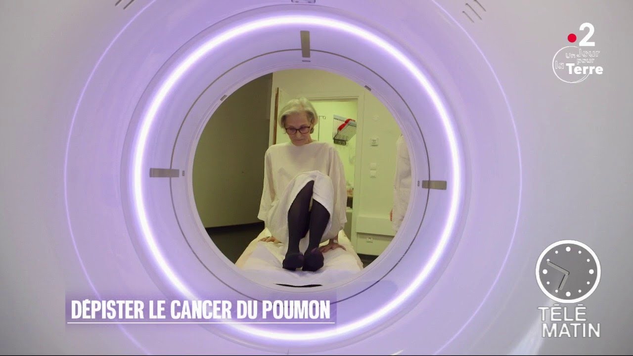 Sant&eacute; - D&eacute;pister le cancer du poumon pour sauver 7500 Fran&ccedil;ais/an
