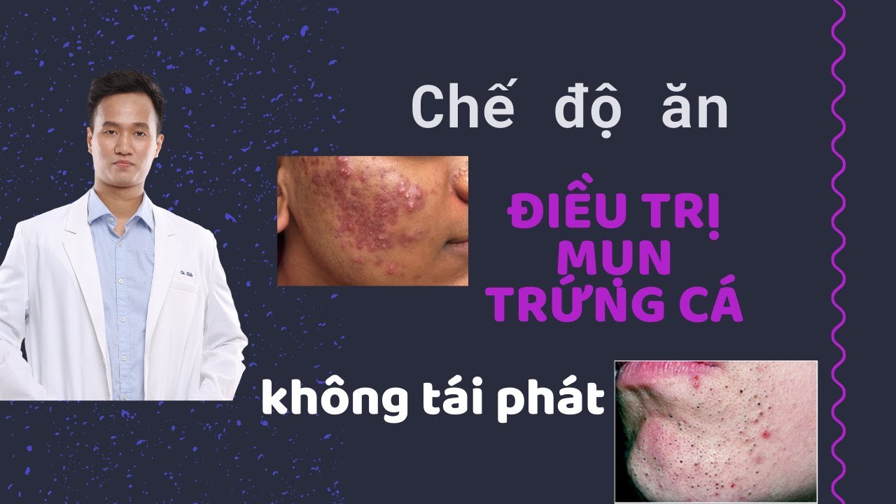Chế độ ĂN - điều trị mụn trứng cá phải biết điều này chia sẻ bởi - Dr Hiếu Aesthetic