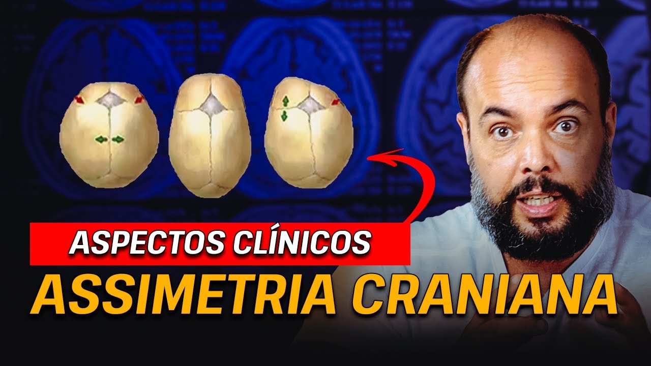 Assimetria Craniana: Aspectos Clínicos #EP3