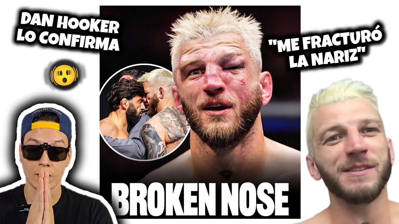 DAN HOOKER confiesa que ARMAN le partió la NARIZ‼️ me hizo enojar😡