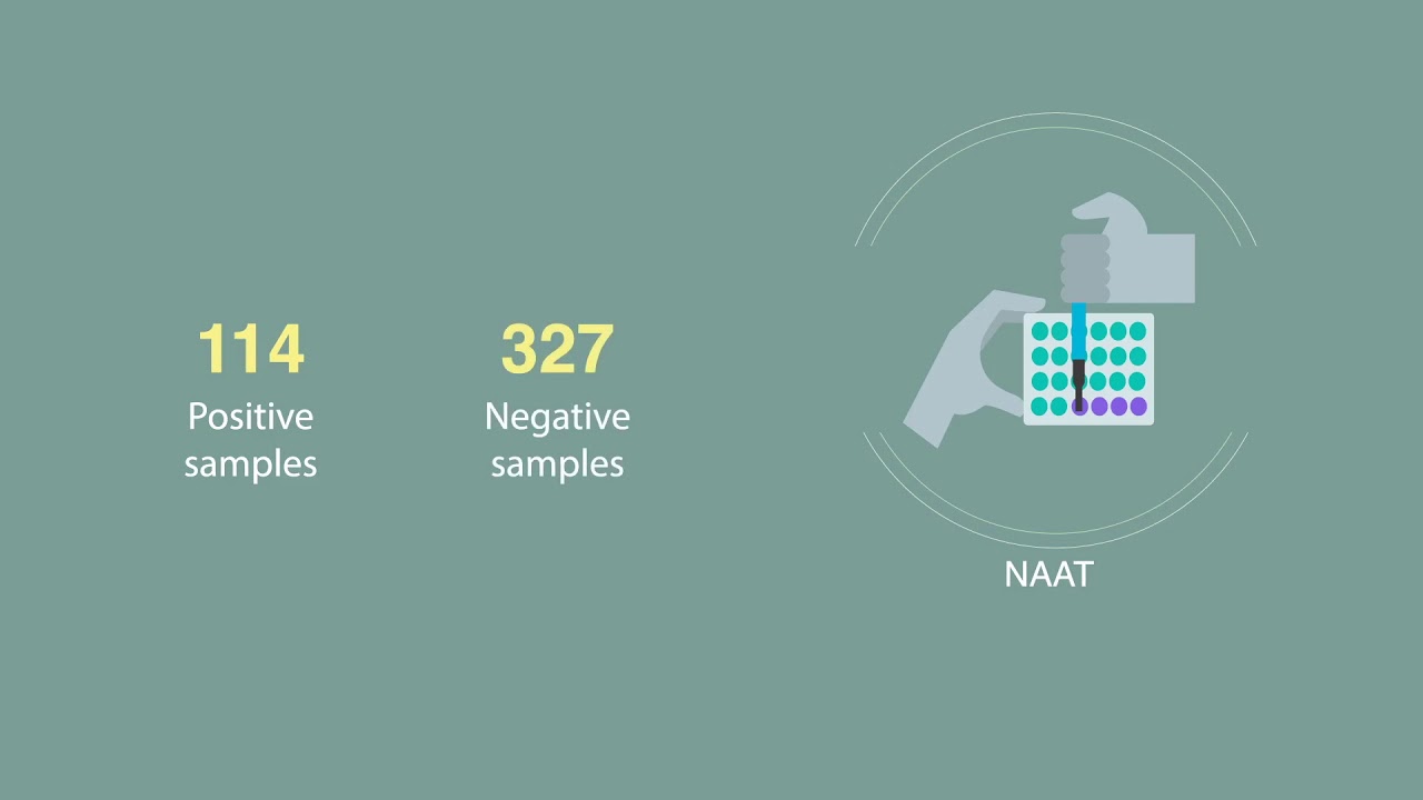 New easy-to-use accurate diagnostic kit for Chlamydia (Ann Lab Med)
