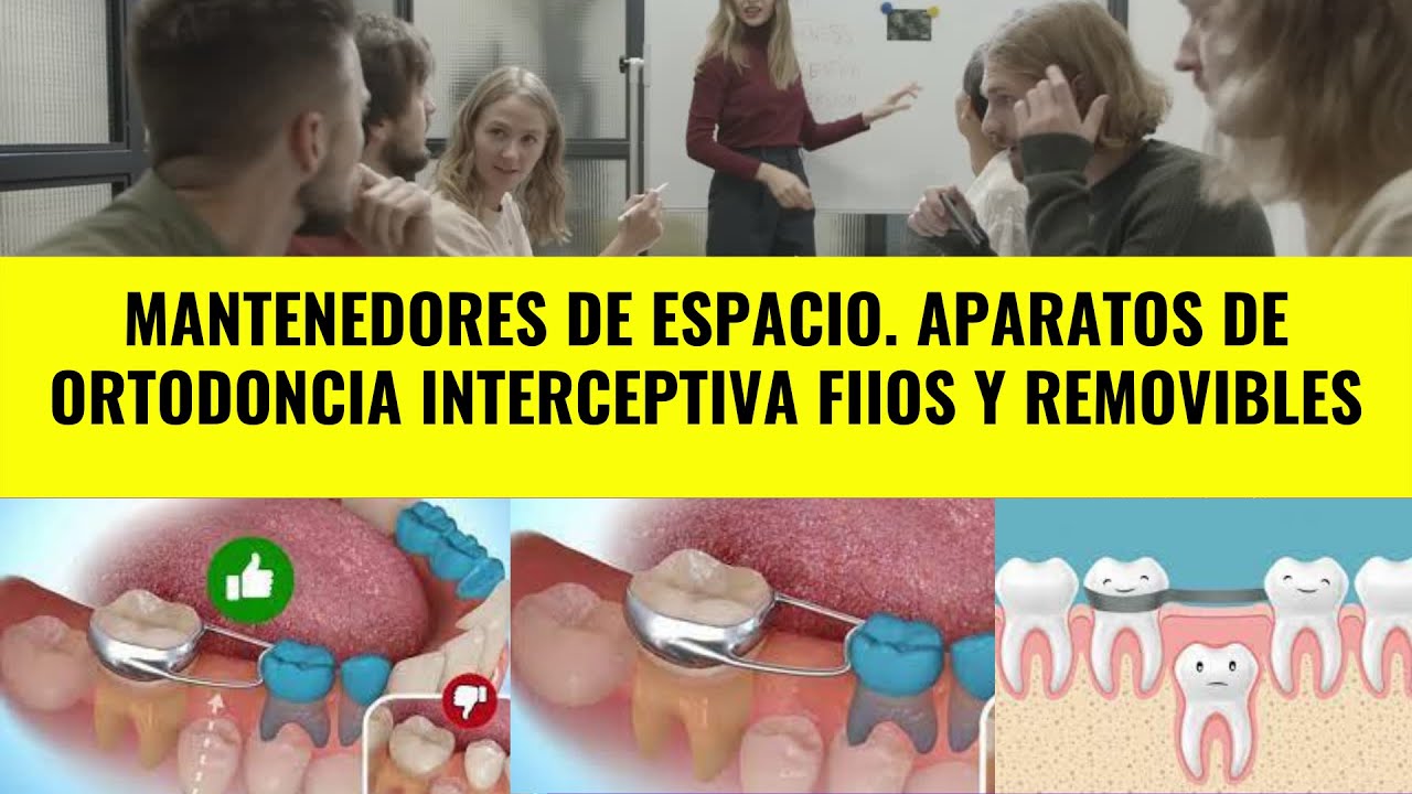 MANTENEDORES DE ESPACIO  APARATOS DE ORTODONCIA INTERCEPTIVA FIIOS Y REMOVIBLES