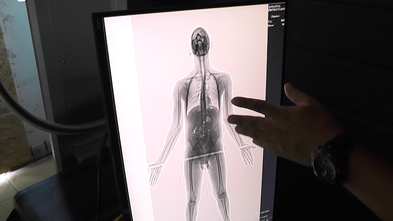 SCANNER PRESIDIO