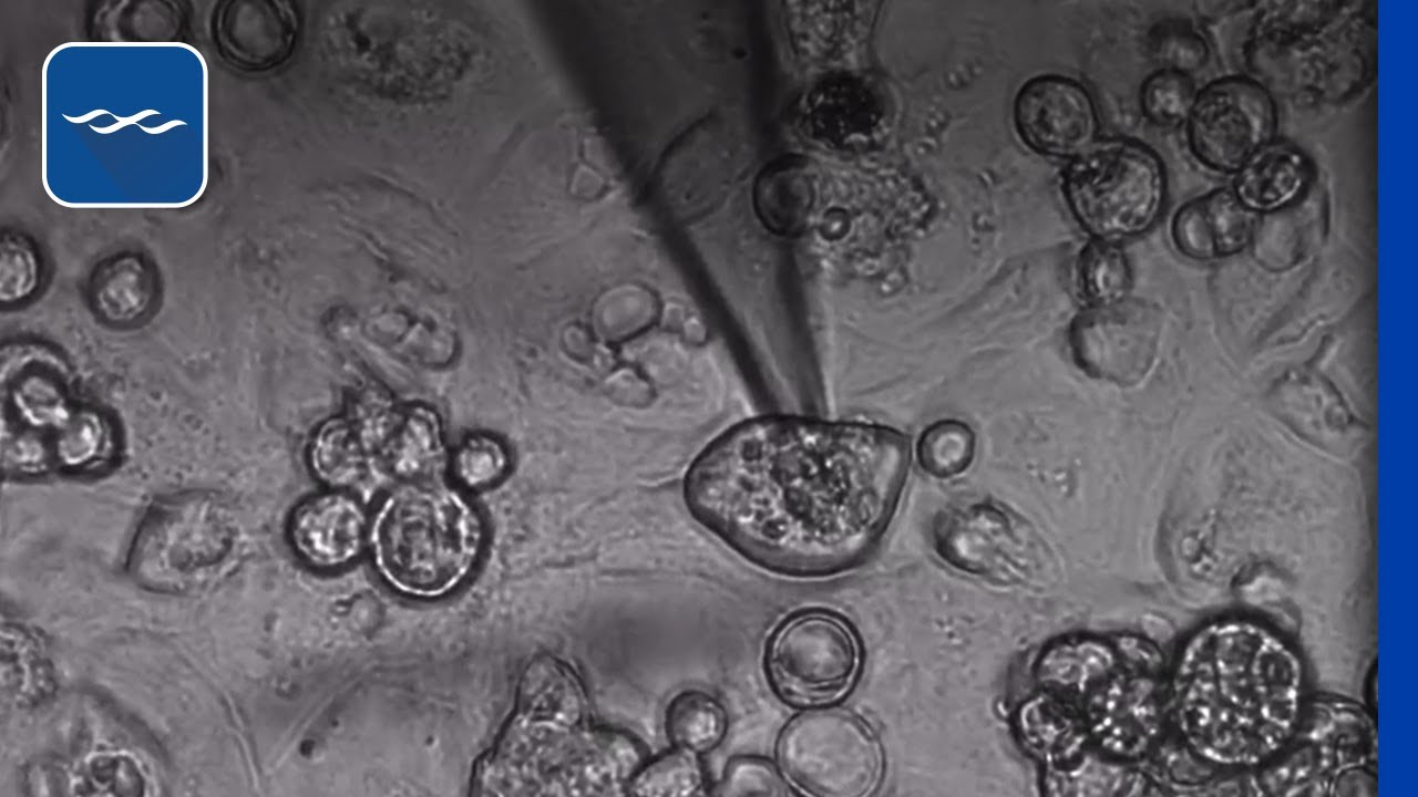 Spontaneous beating of stem cell derived cardiomyocytes