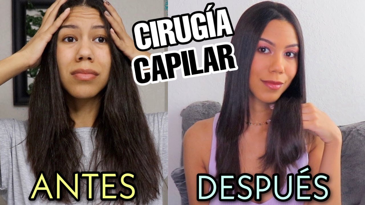 CIRUGÍA CAPILAR DESDE CASA PASO A PASO|COMO APLICAR CIRUGÍA CAPILAR