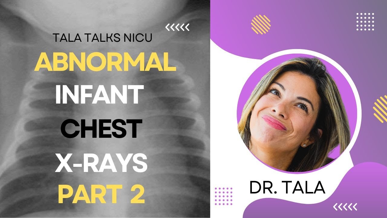 Neonatal CXRs made easy: CDH?? Effusions?? Pneumothorax?!