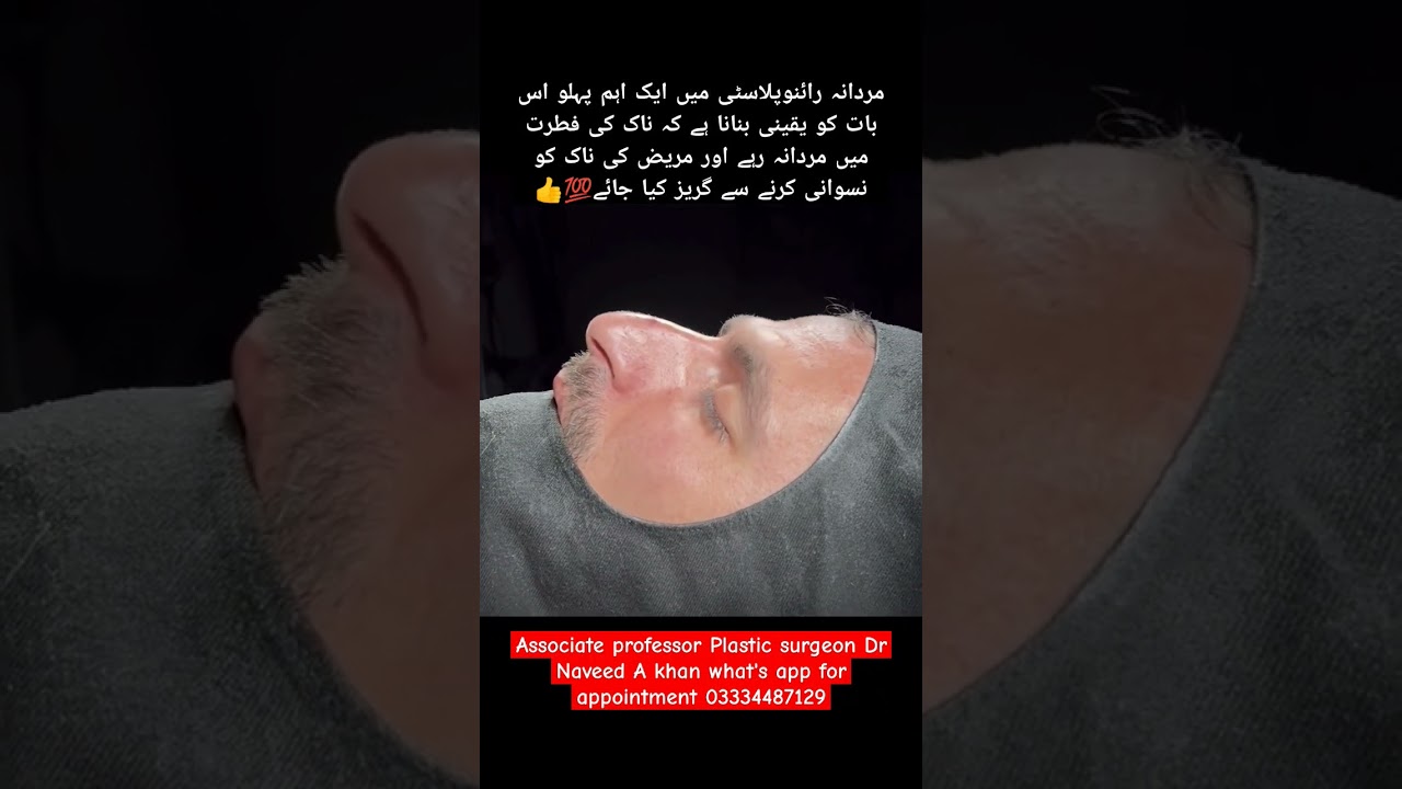 #MaleRhinoplasty#NoseSurgery#FacialSurgery#CosmeticSurgery#PlasticSurgery#MenBeauty#NoseJob