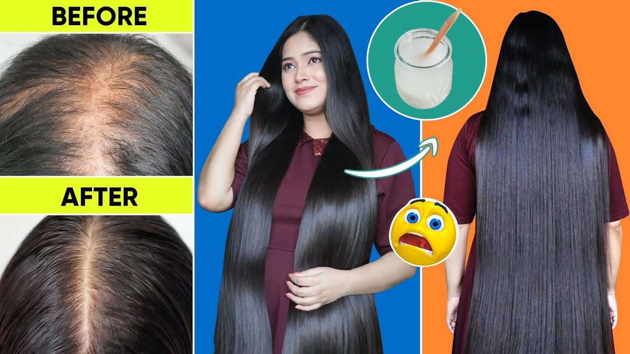 😱ये कर लो गंजे सर पर बाल उगाने का अचूक घरेलू उपाय बालों को मोटा लम्बा मजबूत करने का सबसे असरदार उपाय
