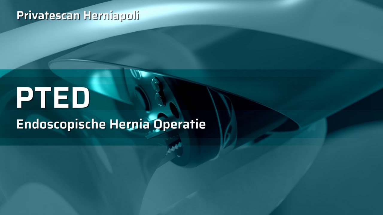 Animatie: PTED hernia operatie - Herniapoli