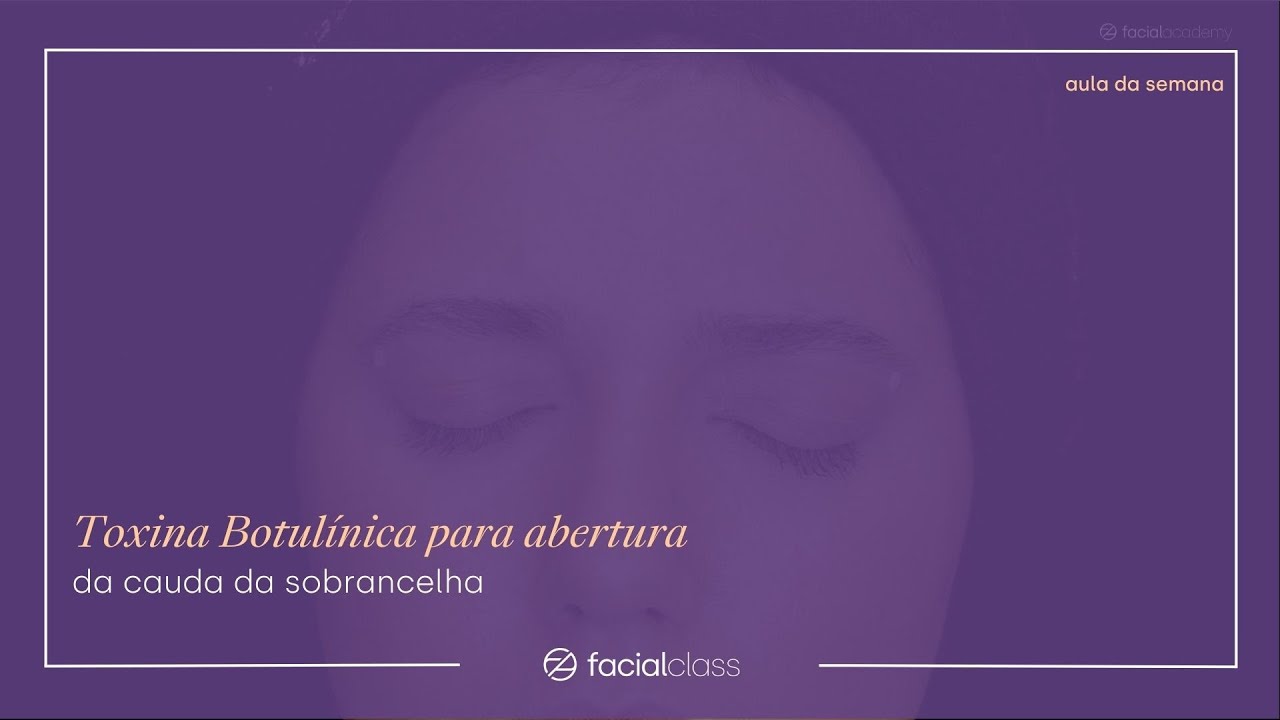 Toxina Botulínica para abertura da cauda da sobrancelha | Facial Class