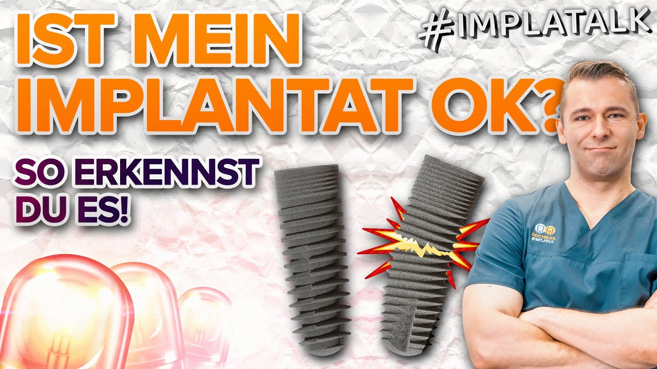 Ist mit meinem Zahnimplantat alles in Ordnung? 😱 - 6 Kriterien für zuhause!