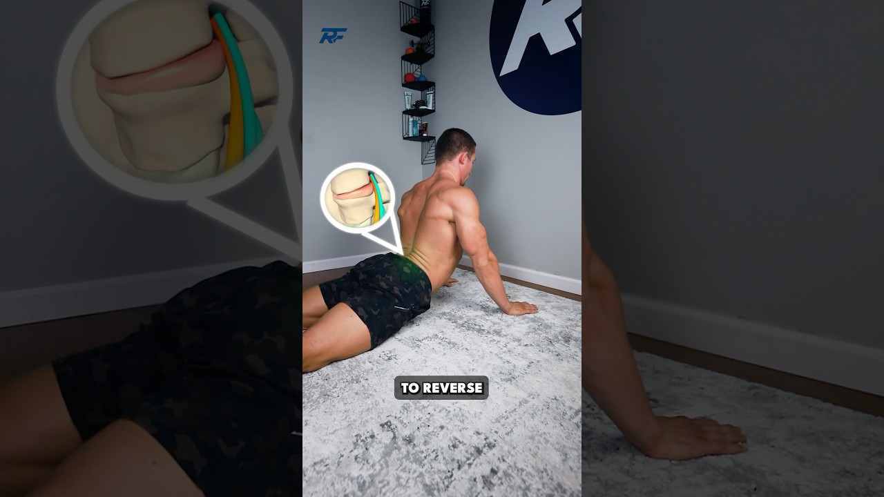 The Worst Way to Fix a Disc Herniation and Sciatica?!